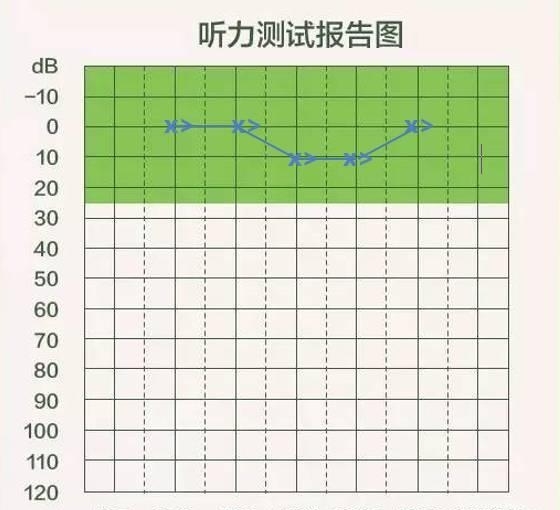 u=577521950,3886231440&fm=173&s=2B4AA05F138F4F4B2245764B0300F074&w=560&h=510&img.jpg