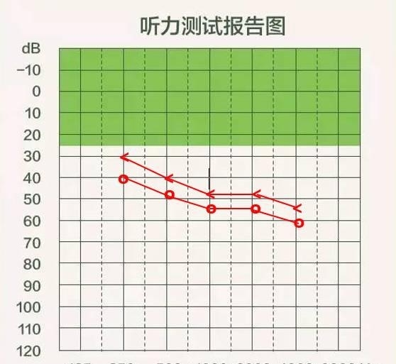 u=1482446358,776272667&fm=173&s=2F4AA05F331F5FCA2A6C164B0300B074&w=558&h=513&img.jpg